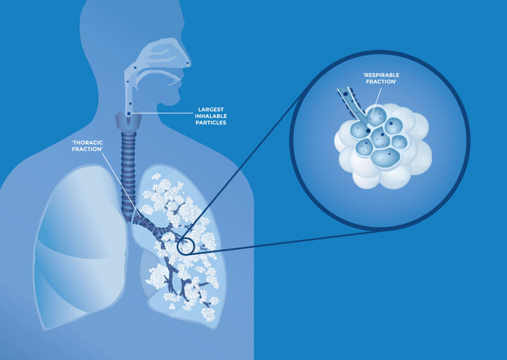 An illustration of human lungs showing the deposition of respirable silica particles within the alveoli.